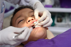 Young boy having a tooth extracted